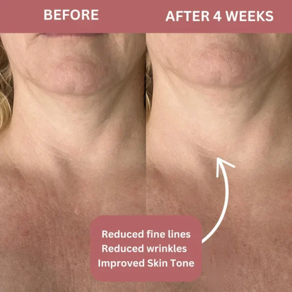 Bio-Collagen kaelamask kollageeniga - Image 3