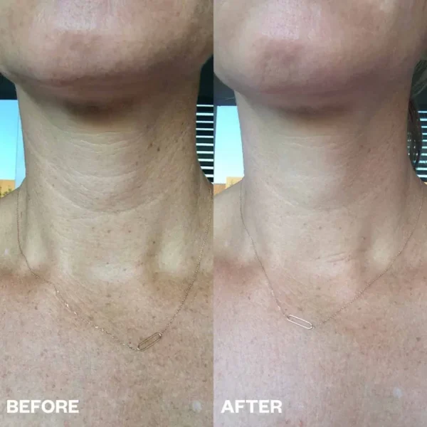 Bio-Collagen kaelamask kollageeniga - Image 4
